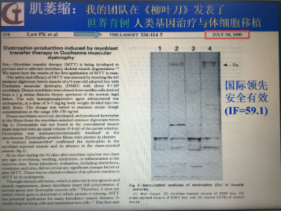 1575941924516931.jpg 柳叶刀论文.jpg