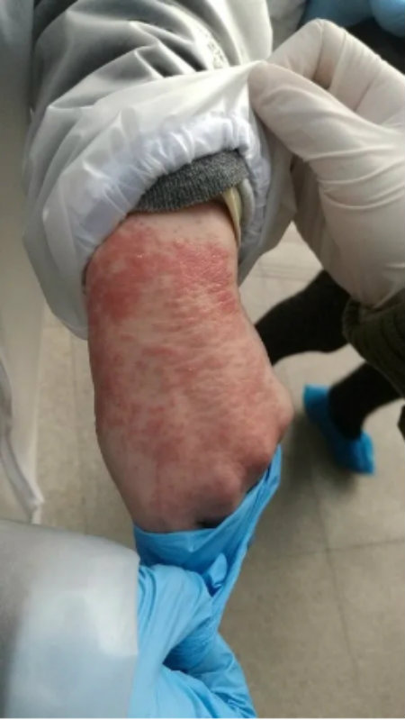 1582462156576128.jpg 防护手套戴久了过敏+.jpg